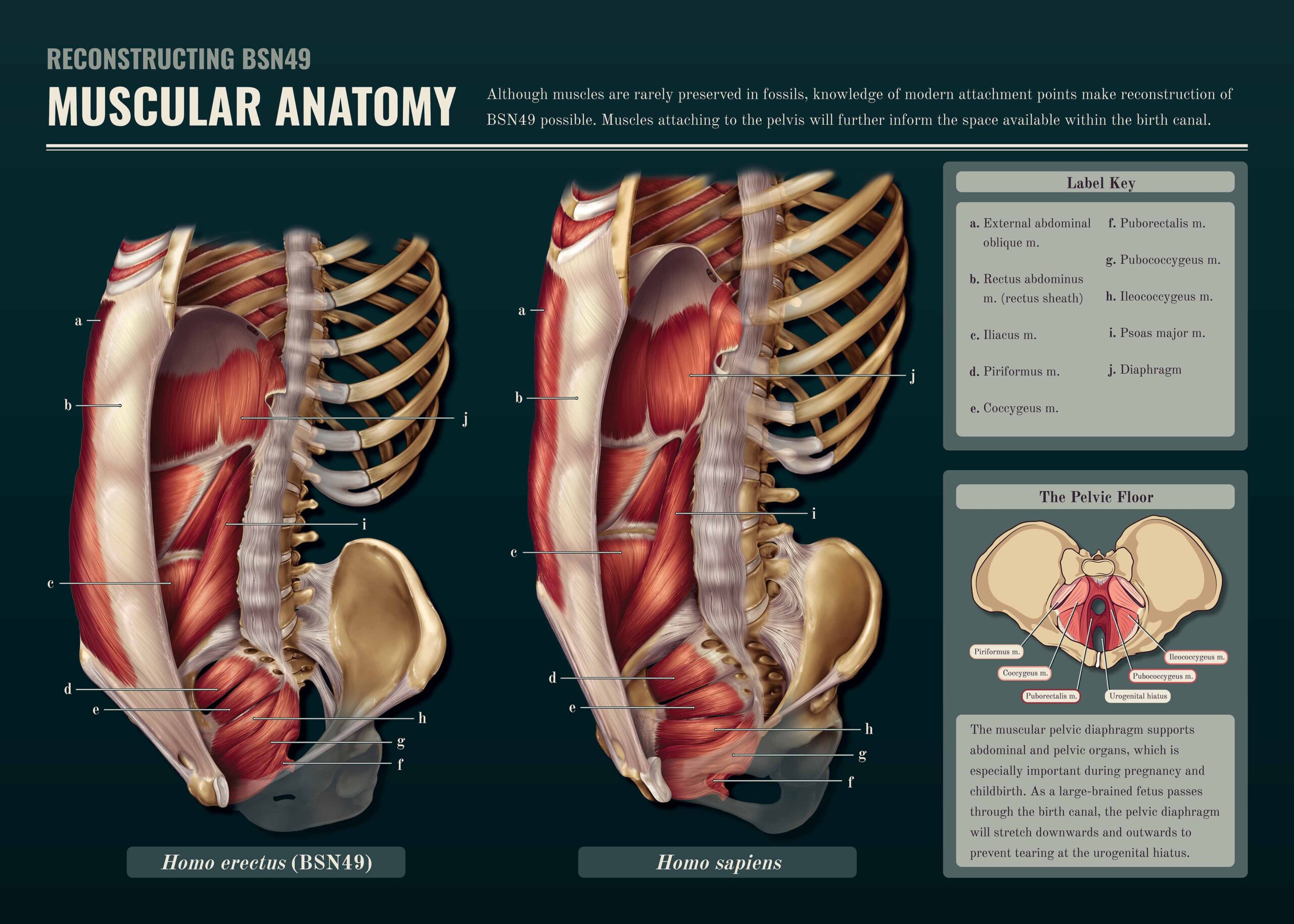 A poster that demonstrates muscular anatomy around the pelvis and pelvic floor.